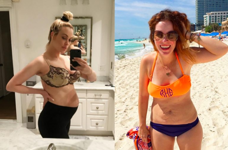 Xxx pics of pregnant celebs in bikinis girl